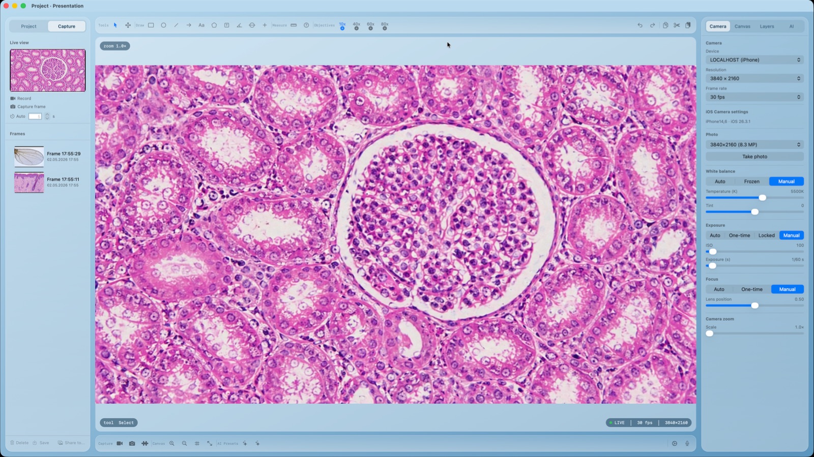 Live iPhone stream inside Microscope Camera